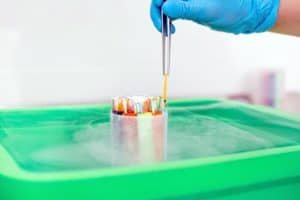 Técnica utilizando uma pinça para retirar embriões congelados de um recipiente resfriado